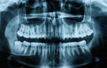 DENTS Zahnästhetik - Diagnose