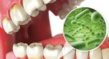 DENTS Mundhygiene