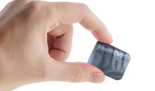 DENTS Implantate - Diagnose DENTS Implantate - Diagnose