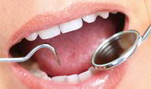 DENTS Implantate - Vorbehandlung DENTS Implantate - Vorbehandlung